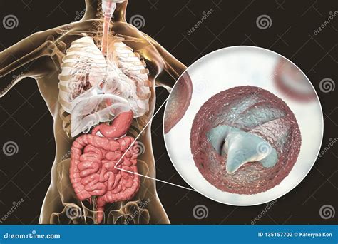  Cryptosporidium: ¡Un microbio imparable que causa estragos en el tracto digestivo!