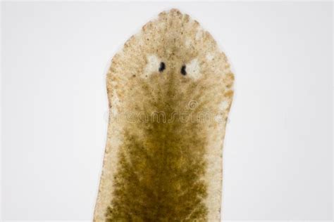  Quizzing Quingia: Unearthing the Secrets of this Fascinating Flatworm Parasite!