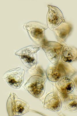  Vorticella una mirada microscópica a un depredador diminuto con tentáculos giratorios!